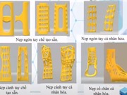 Công nghệ in 3D: Chế tạo nẹp chấn thương chỉnh hình